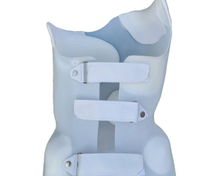 Pain with Scoliosis Bracing?